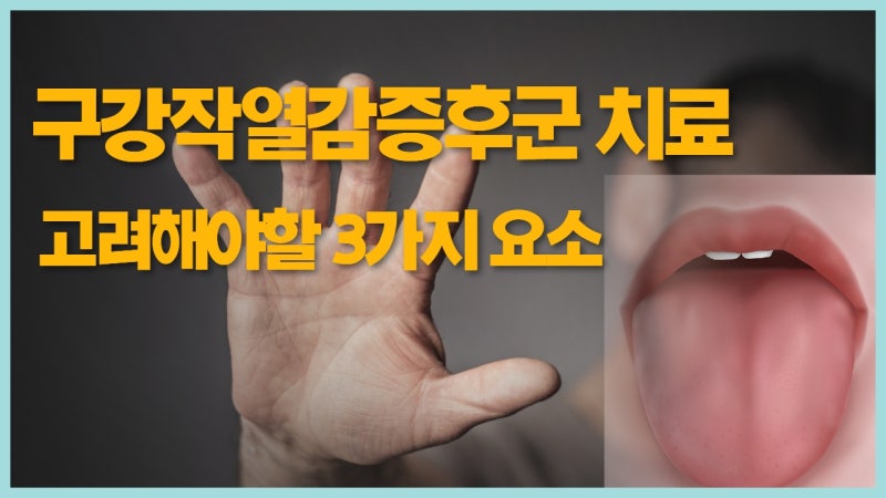 구강작열감증후군 치료