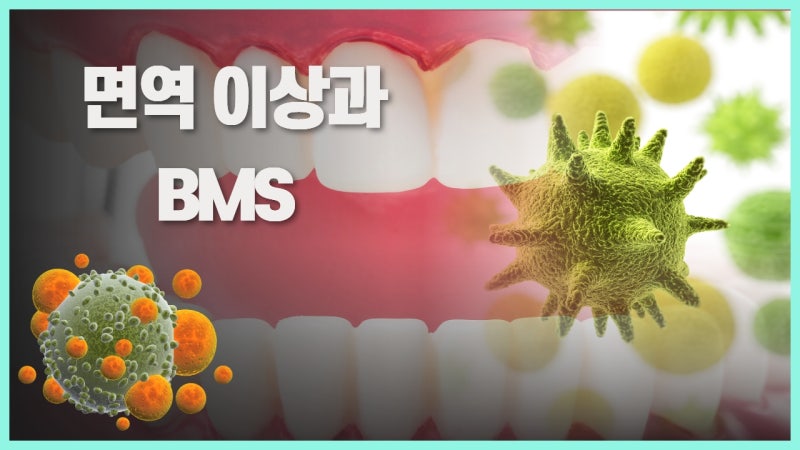 면역 질환과 BMS