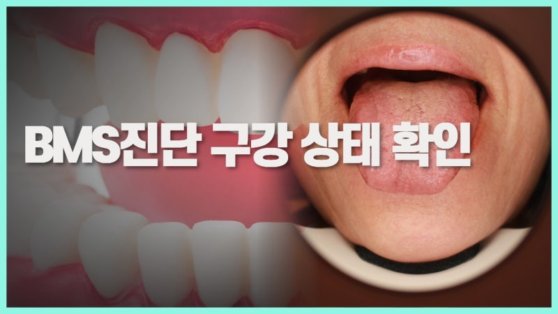 구강 상태 확인