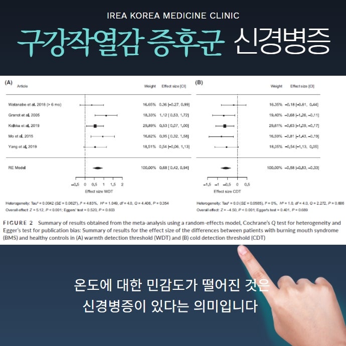구강작열감 증후군과 신경병증