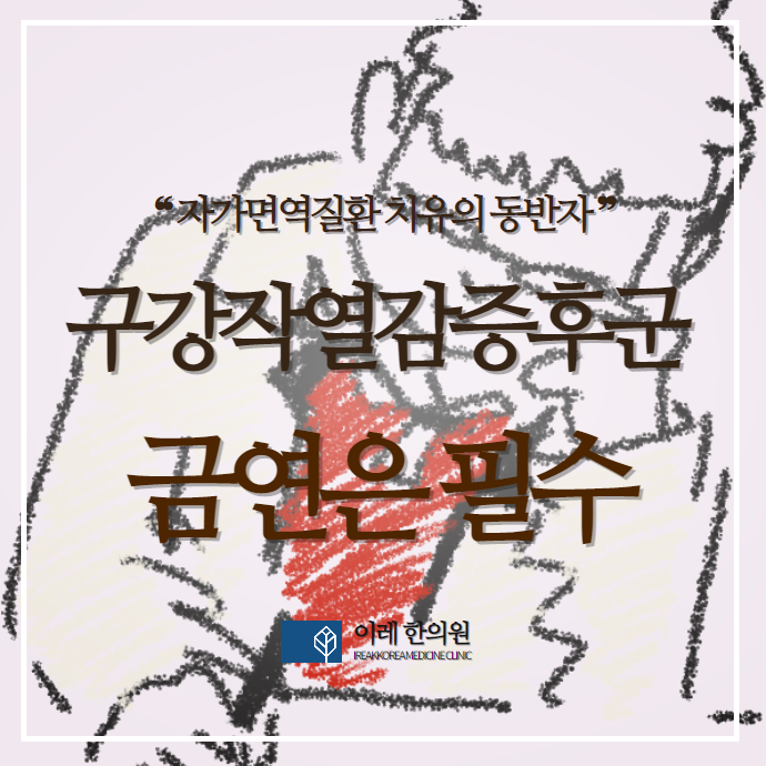 구강작열감증후군