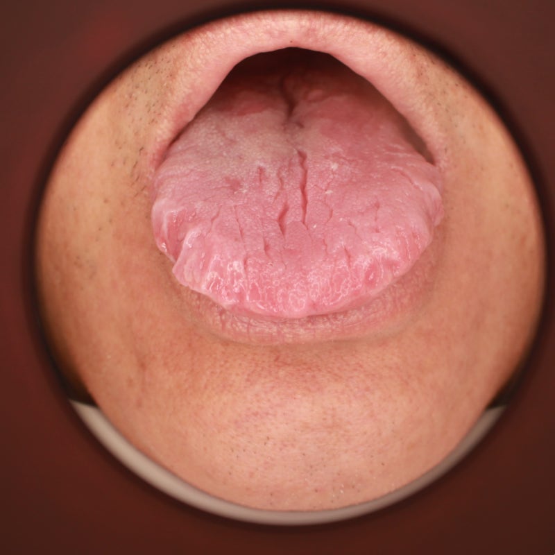 지도설과 균열설