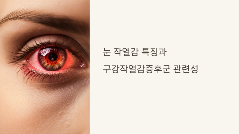 눈 작열감 증후군 개요