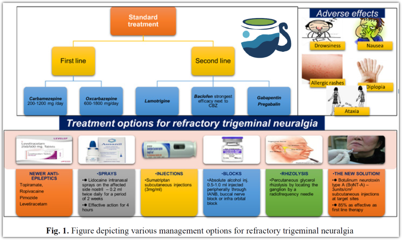 삼차신경통 치료약