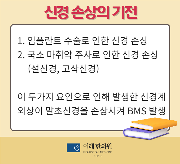 임플란트 이후 발생하는 혀 통증