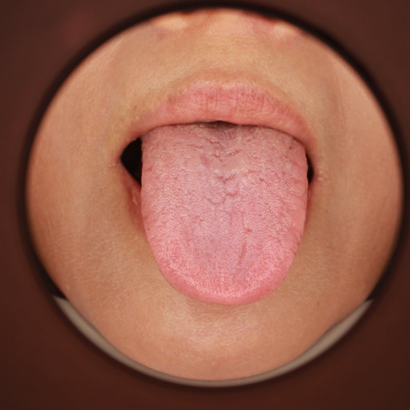 입술 통증 원인