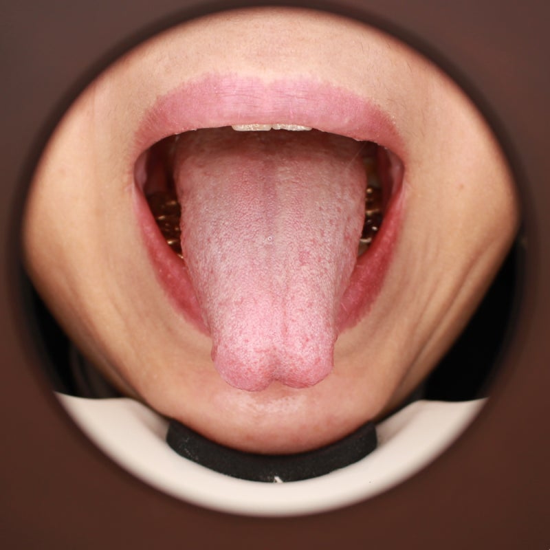 염증성 사이토카인 경로