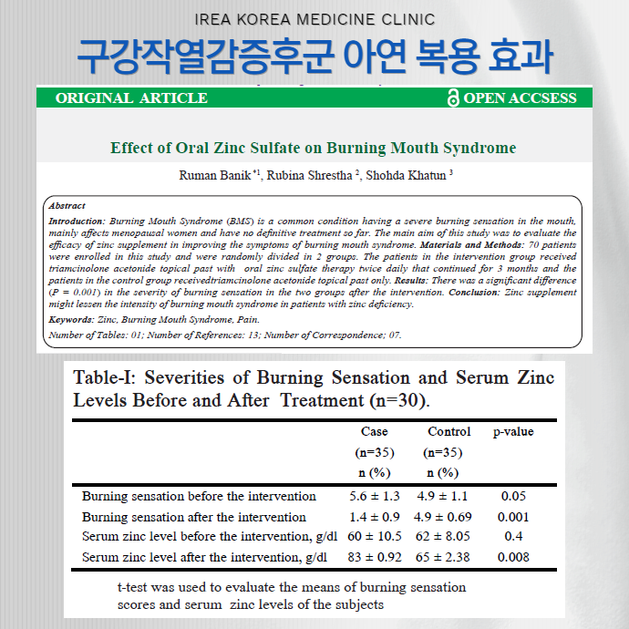 구강작열감증후군과 아연 보충제