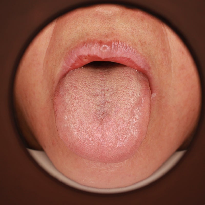 치료의 3가지 축