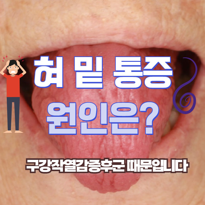 혀 밑 통증 원인