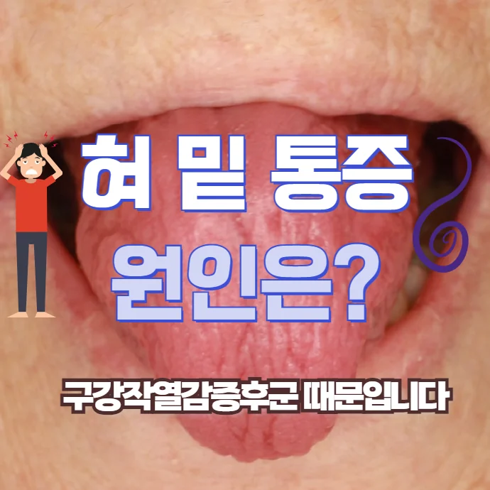 혀 밑 통증 원인