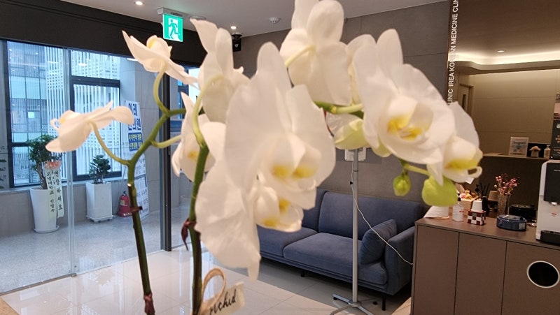 구강작열감증후군 치료