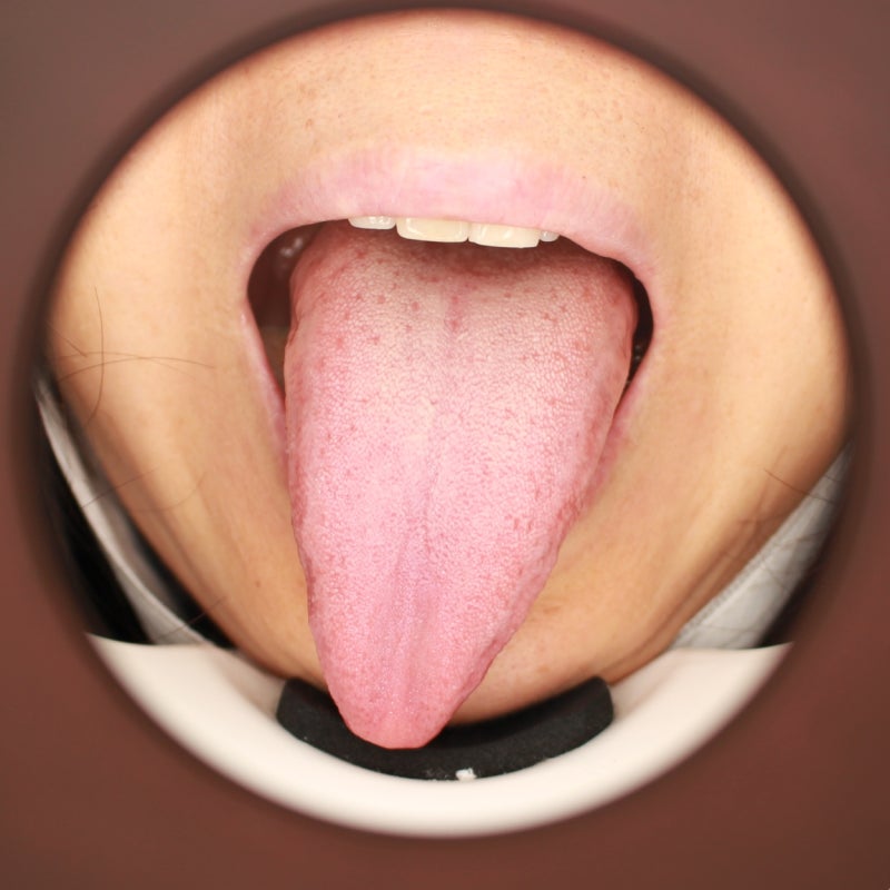 혀 통증 부위