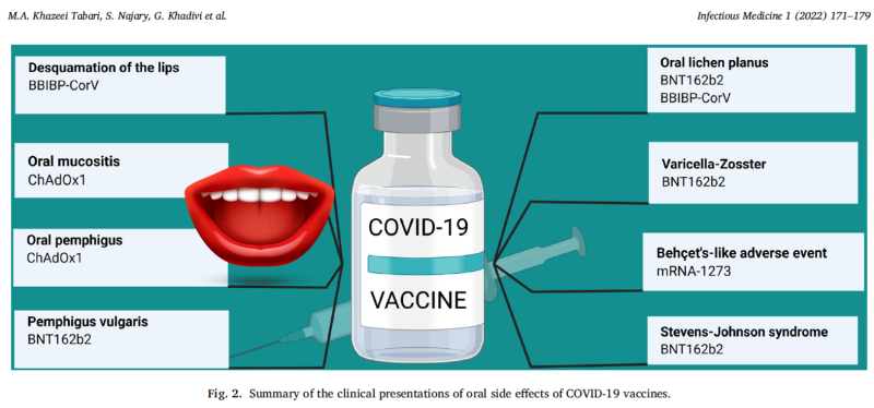 백신 후 구강 후유증