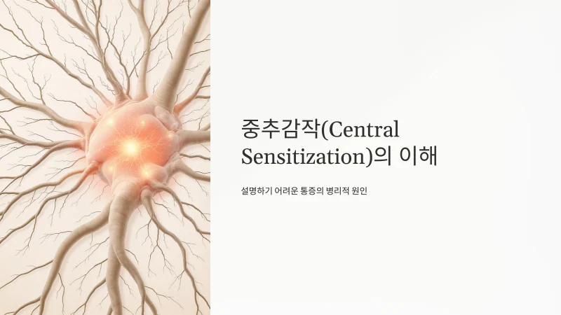 중추 감작 설문(CSI), 내 통증이 '진짜'인지 확인하는 25가지 질문