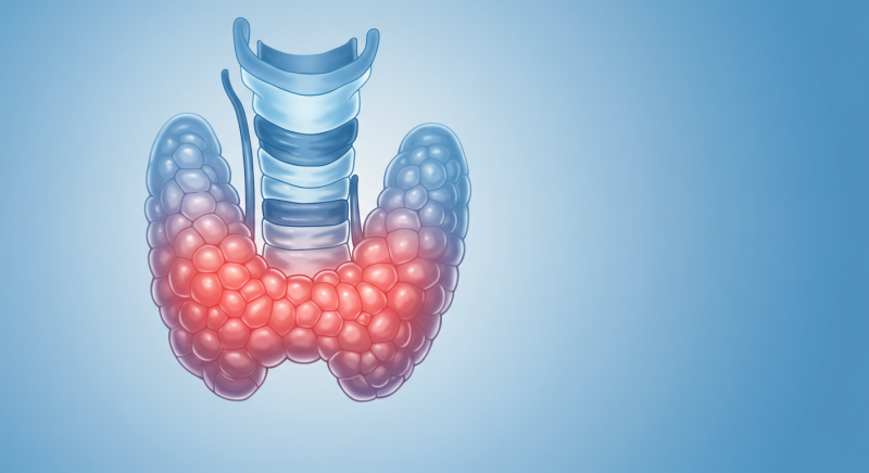갑상선기능저하증이 있을 때 혀 통증이 생긴다면 — 구강작열감증후군과의 관계