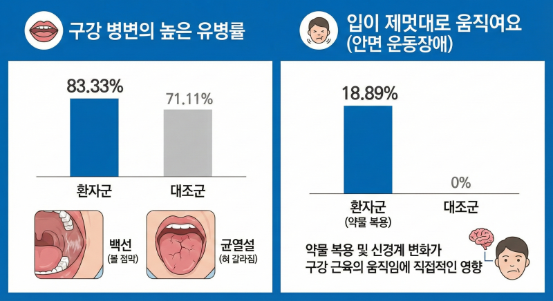이상 운동증