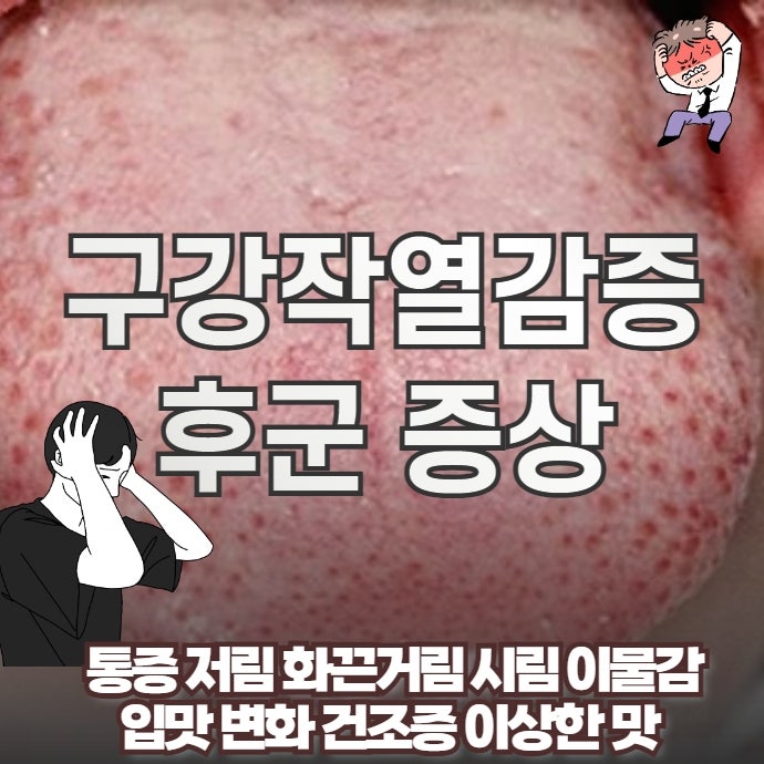 구강작열감증후군 증상 총정리 — 통증부터 인지기능 저하까지