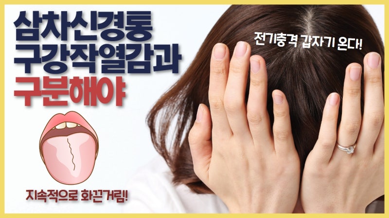 삼차신경통과 구강작열감증후군, 어떻게 구별하나요? 핵심 감별점 정리