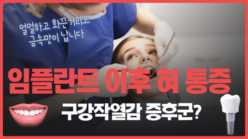 임플란트 후 혀 통증 원인 3가지 — 금속 알러지, 신경 손상, 구강작열감증후군
