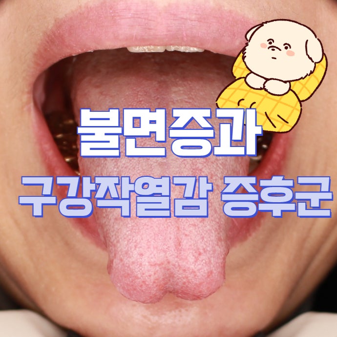 잠을 못 자면 혀 따가움이 심해지는 이유 - 불면증과 구강작열감증후군의 관계