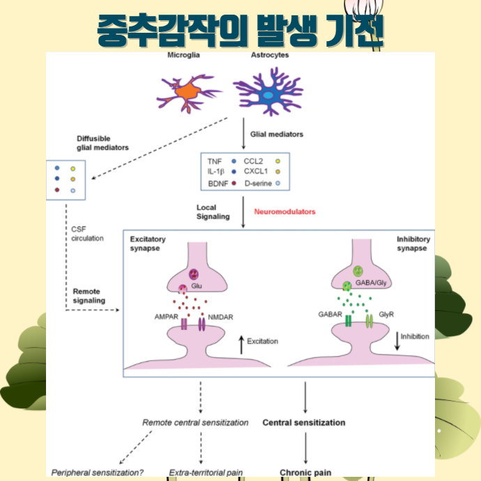 악순환 구조 도식