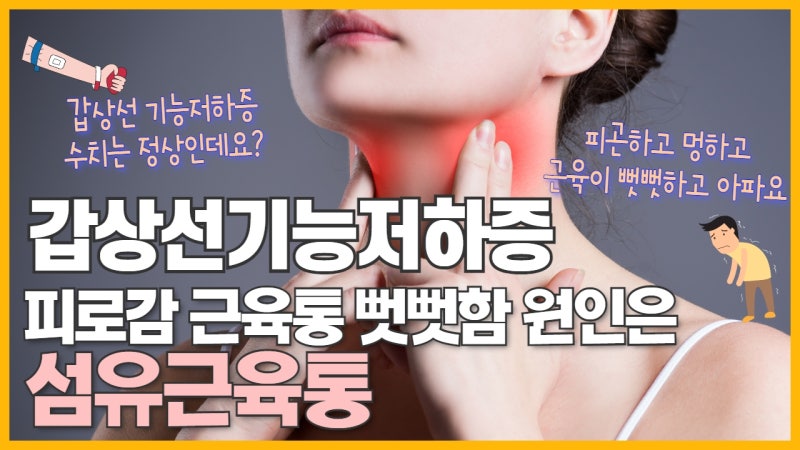갑상선기능저하증 (하시모토 갑상선염) 근육통 관절통 피로감이 계속된다면 섬유근육통이 원인일 수
