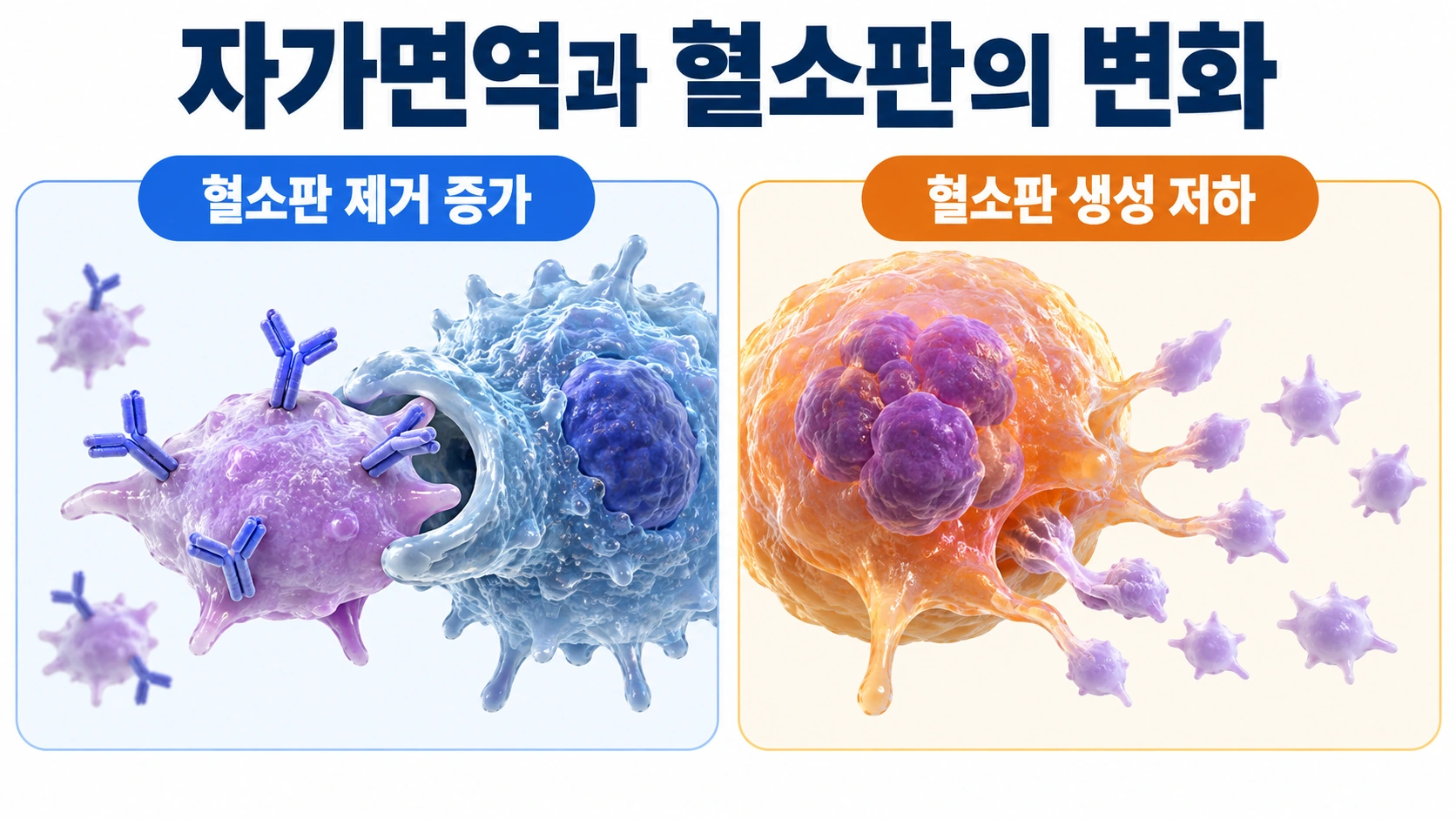 자가면역에 따른 혈소판 제거 증가와 혈소판 생성 저하를 구분한 의학 모식도
