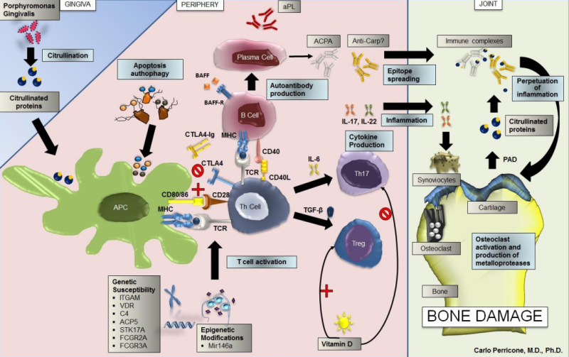 루푸스 관절염 병리기전
