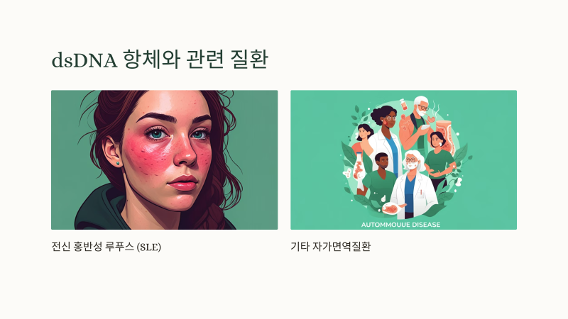 dsDNA 항체와 SLE 예후