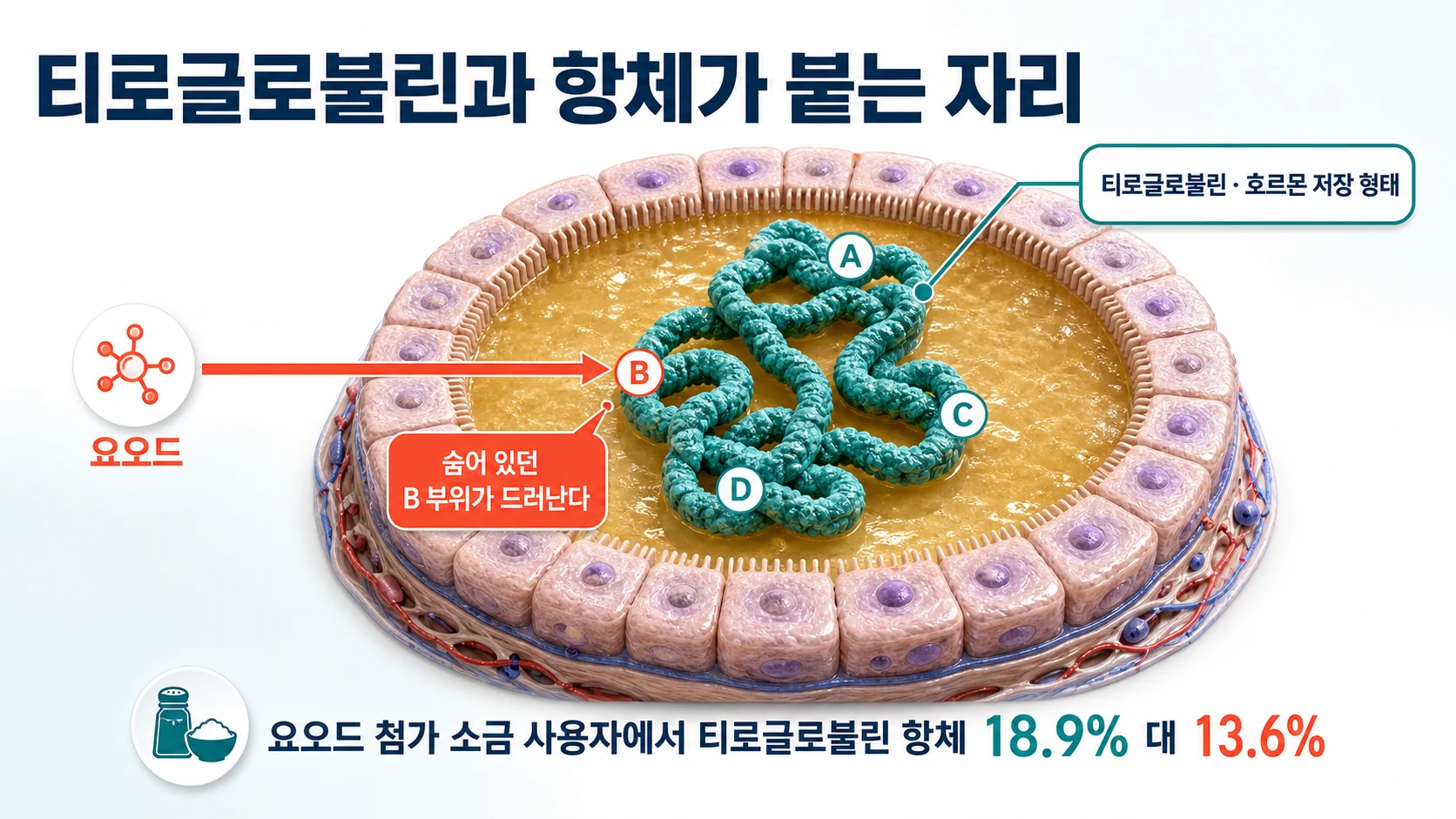 여포 안 티로글로불린과 항체 인식 부위