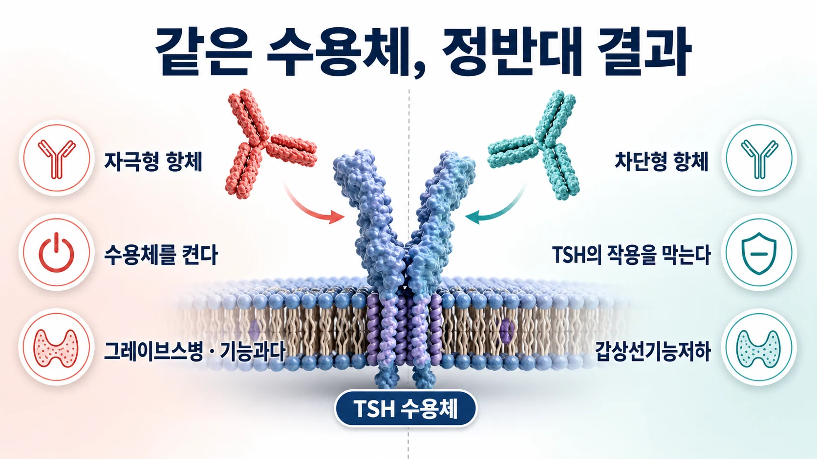 TSH 수용체 항체의 자극형과 차단형 갈림길