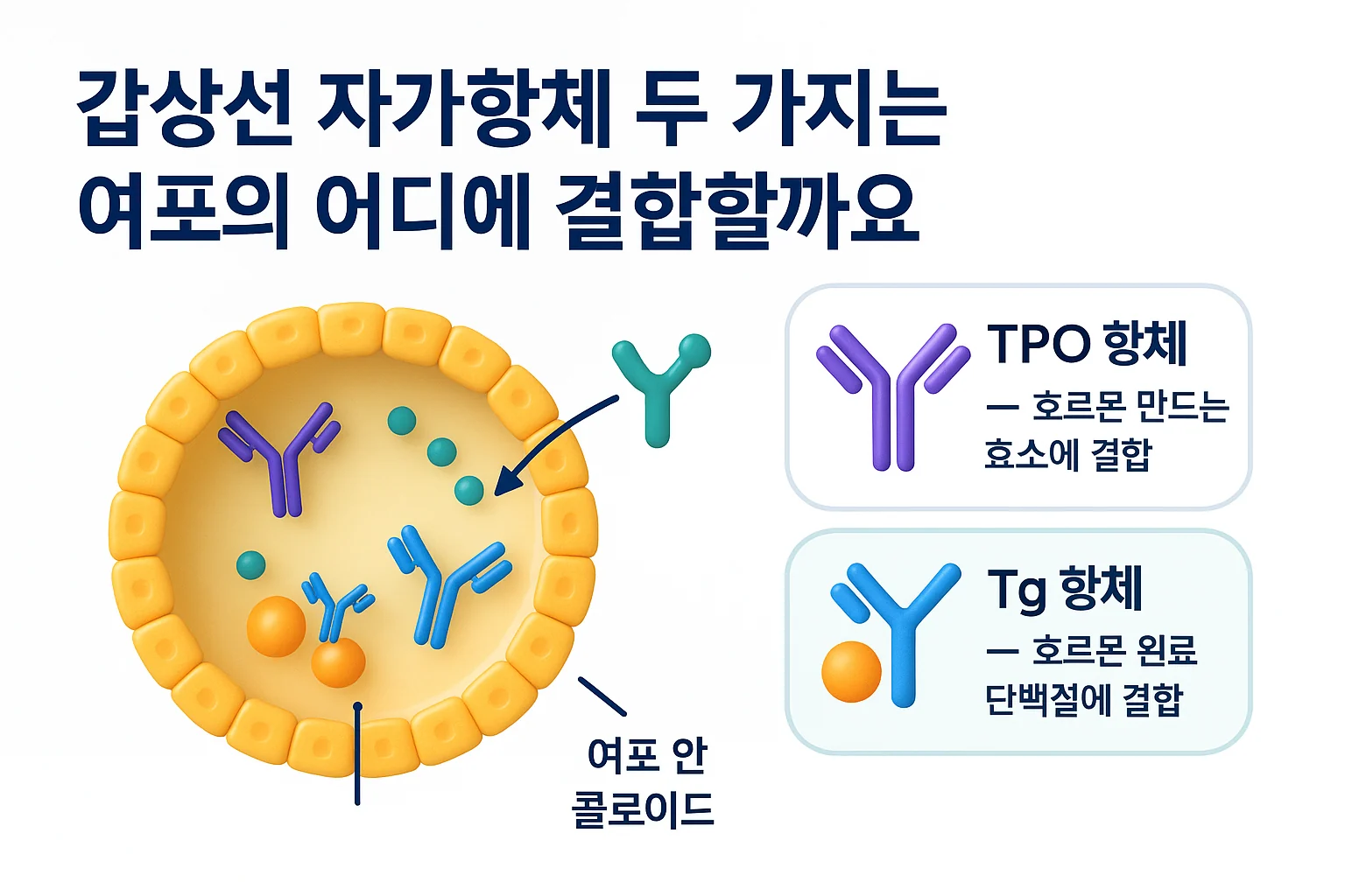TPO 항체와 Tg 항체가 갑상선 여포의 어느 구조에 결합하는지 나타낸 모식도