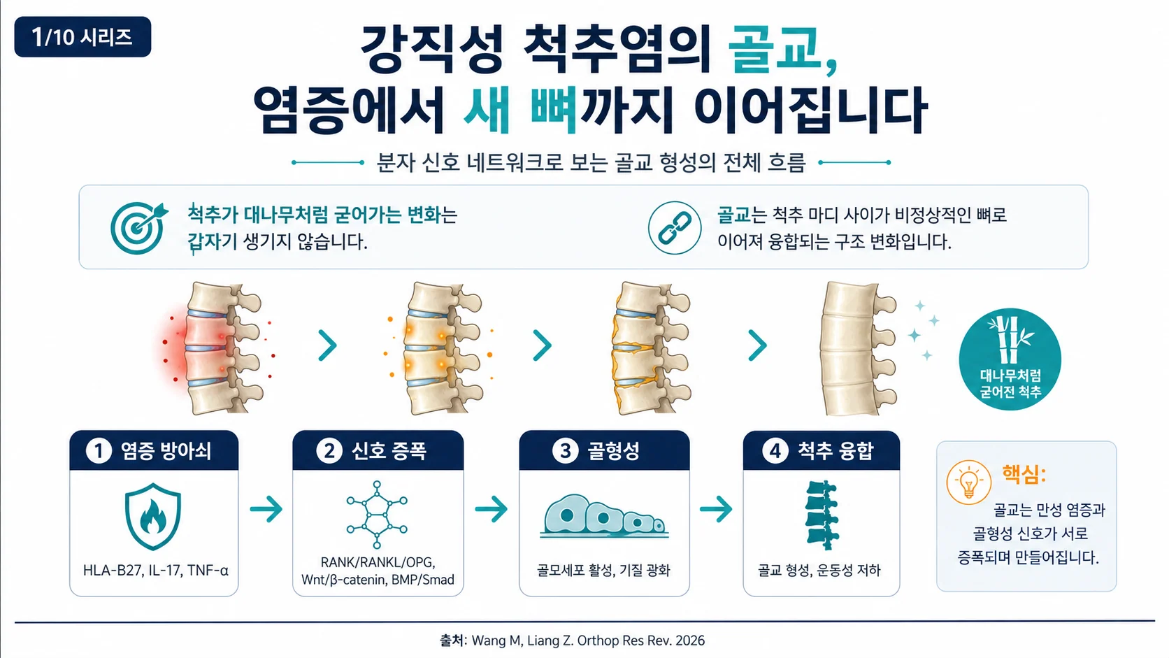 강직성 척추염의 골교, 염증에서 새 뼈까지 — 핵심 요약