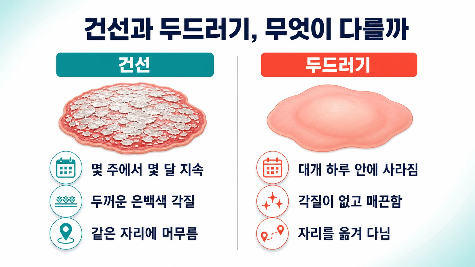 두 질환의 병변 비교