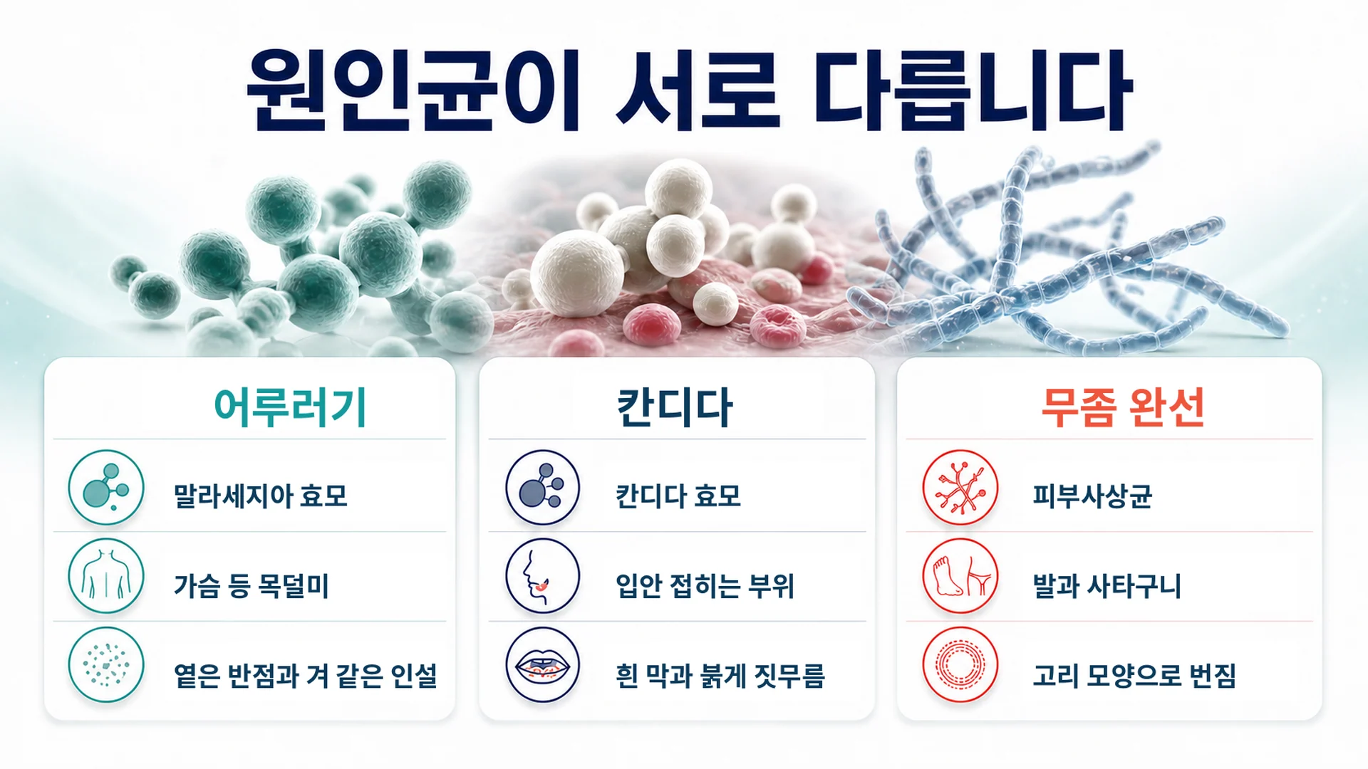 어루러기와 칸디다, 무좀의 원인균과 나타나는 자리를 비교한 이미지