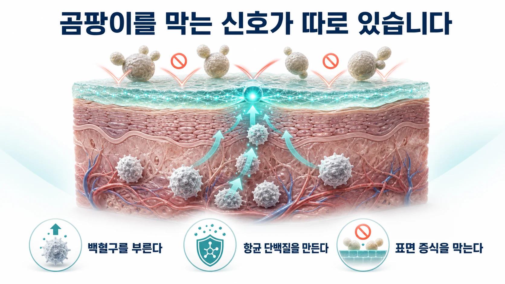 인터루킨-17이 피부에서 곰팡이를 막는 방어선 역할을 하는 구조를 설명하는 이미지