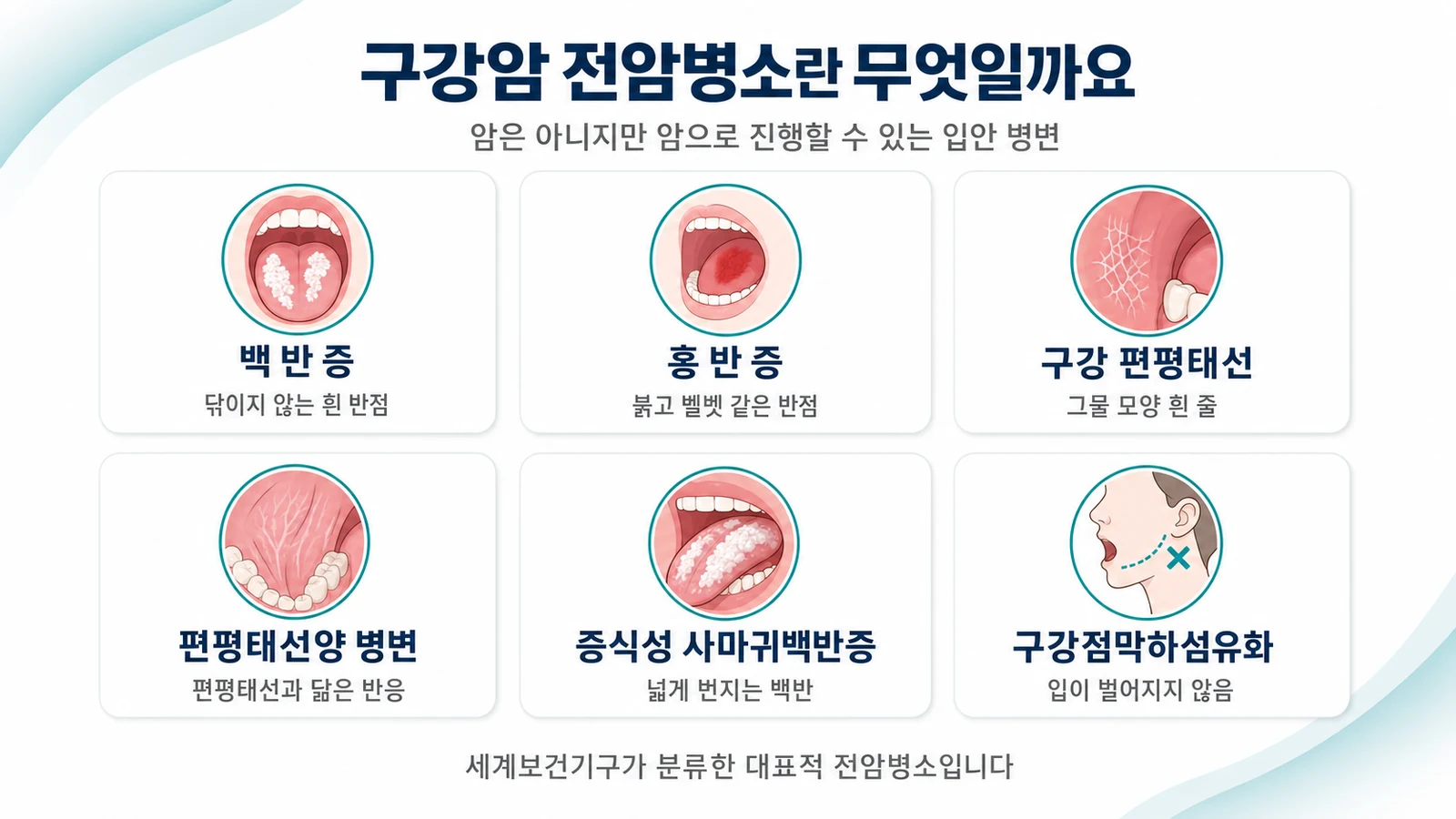 구강암 전암병소란 무엇일까