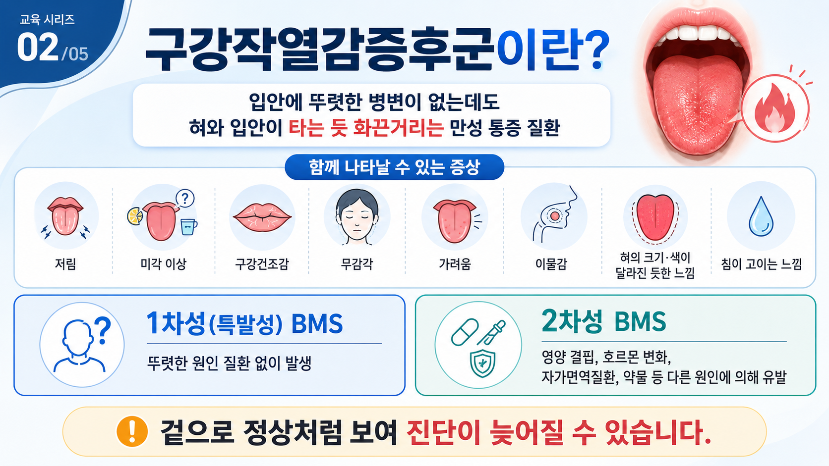 구강작열감증후군이란 — 동반 증상과 1차성·2차성 분류