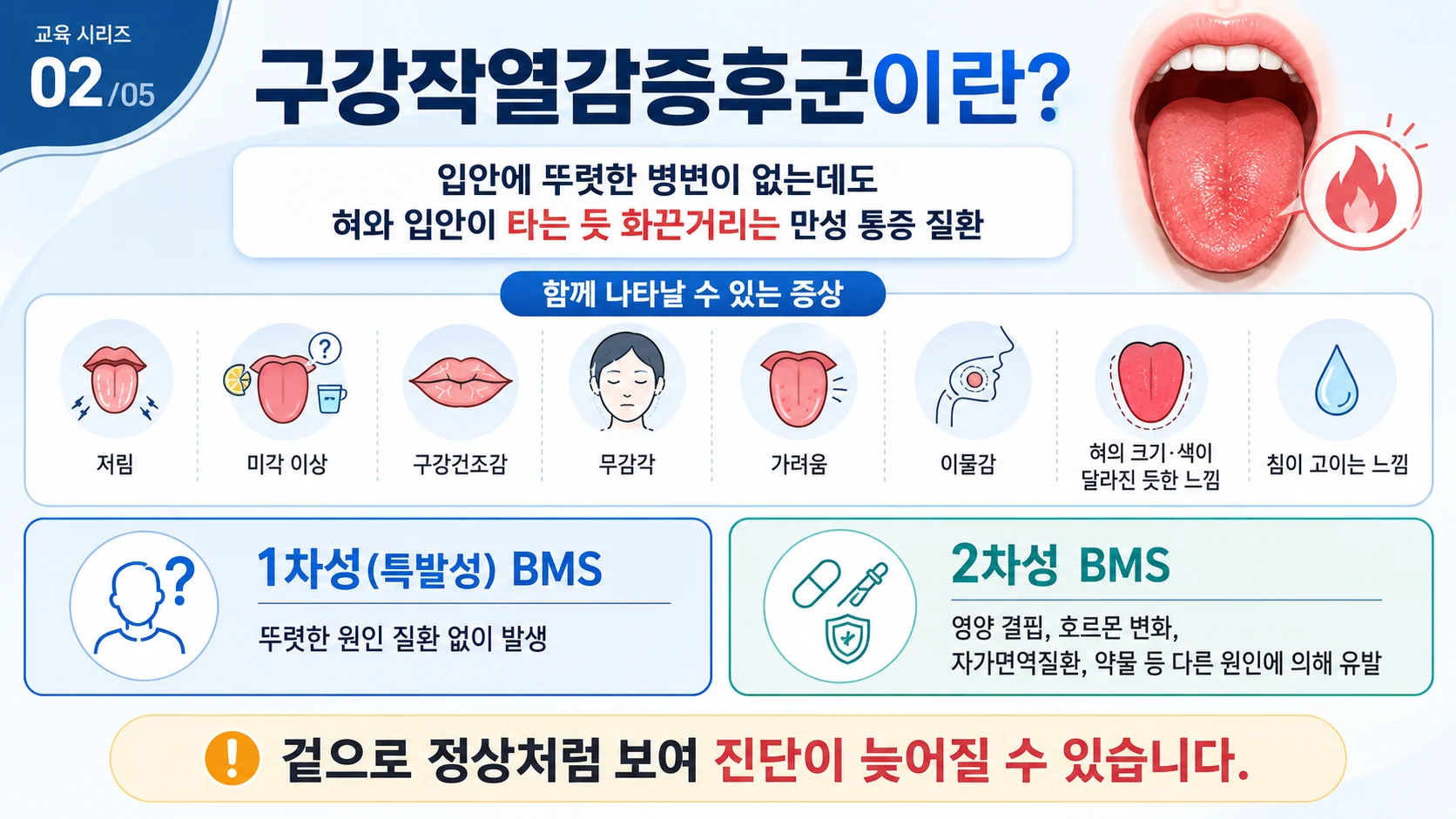 구강작열감증후군이란 — 동반 증상과 1차성·2차성 분류