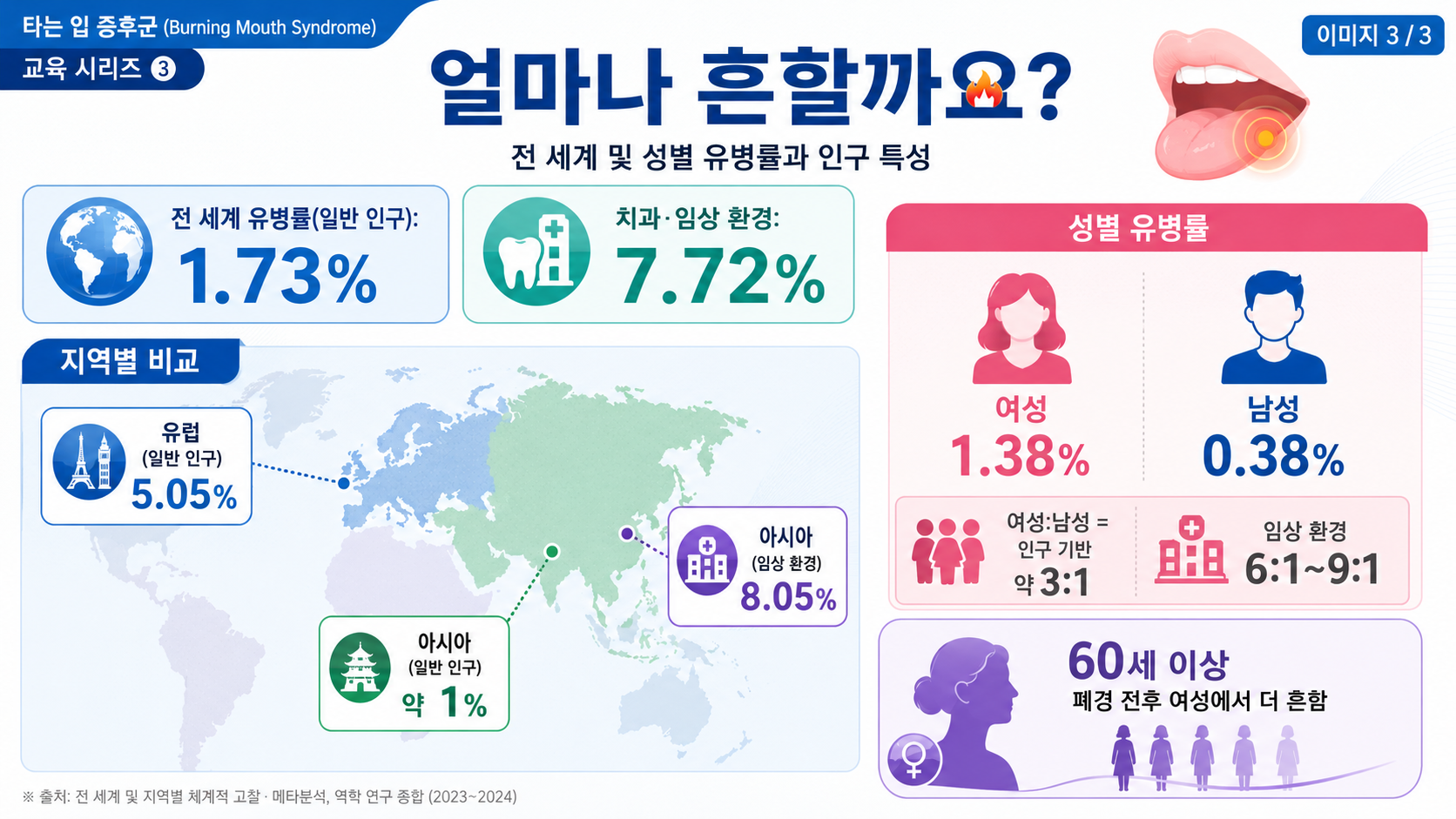 구강작열감증후군 유병률 — 일반 1.73% vs 임상 7.72%, 성별·연령 분포