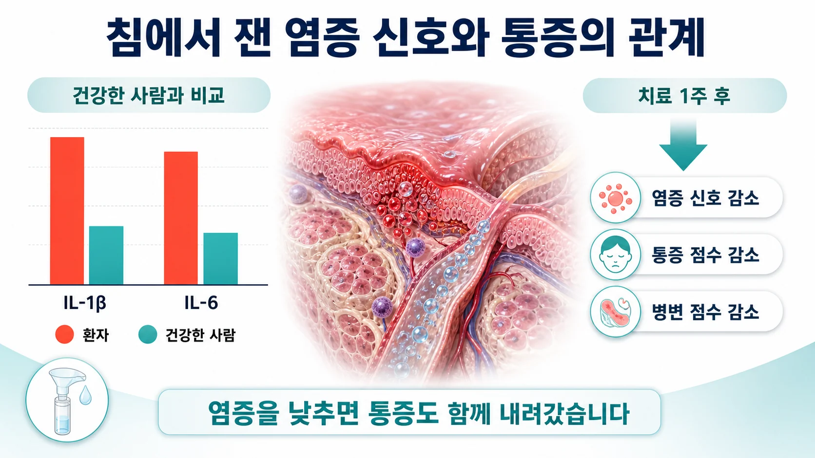 구강편평태선 환자의 침에서 IL-1β와 IL-6이 높아져 있고 부신피질호르몬제 투여 후 통증 점수와 함께 낮아지는 변화를 보여주는 그림
