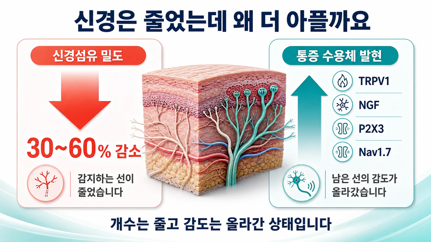 구강작열감증후군에서 신경섬유 밀도는 30~60% 줄어드는데 TRPV1과 NGF, P2X3 같은 통증 수용체 발현은 오히려 늘어나는 대비를 보여주는 그림