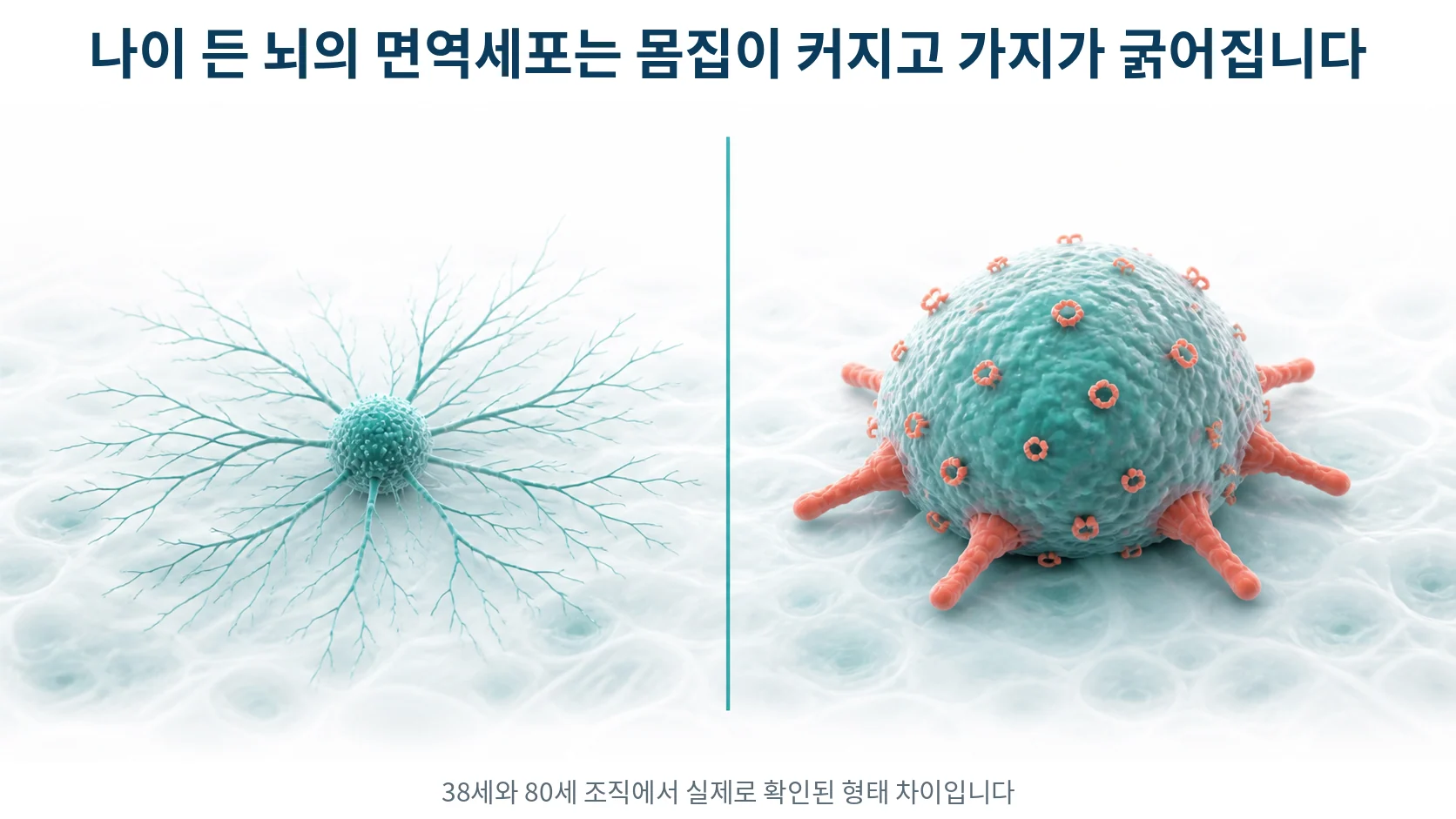 왼쪽에는 작은 세포체에 가는 가지를 가진 세포가, 오른쪽에는 세포체가 커지고 가지가 굵고 짧아진 세포가 그려진 비교 그림