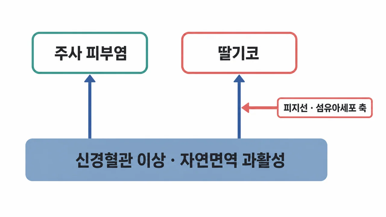 주사 피부염과 딸기코의 관계 정리