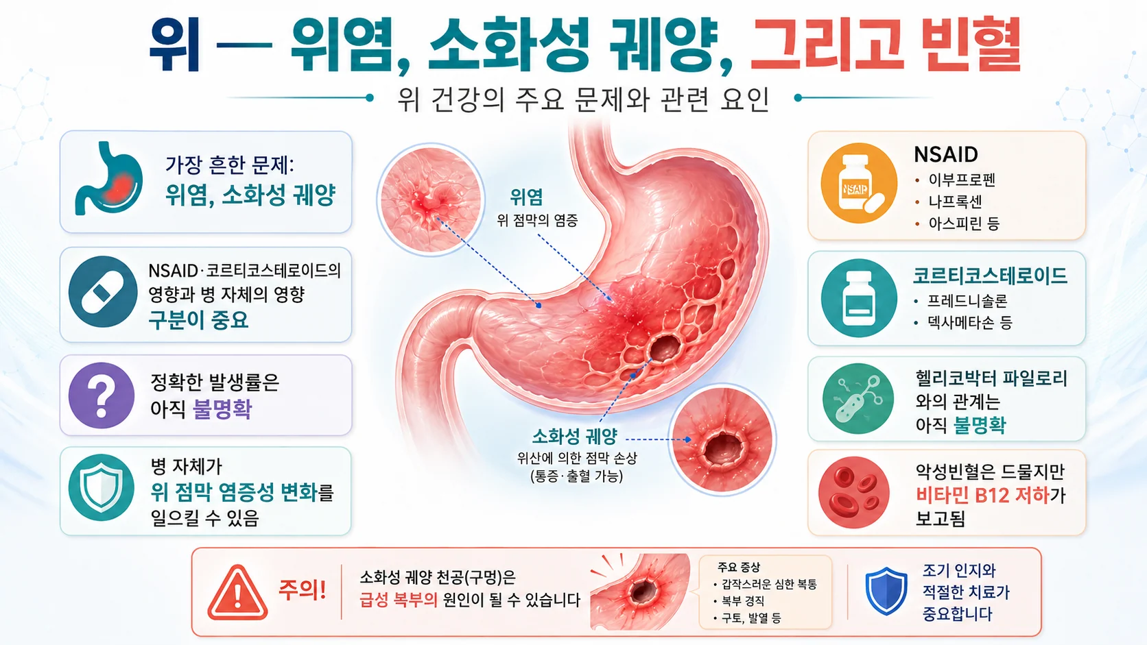 위 — 위염·소화성 궤양과 약물·헬리코박터의 관계