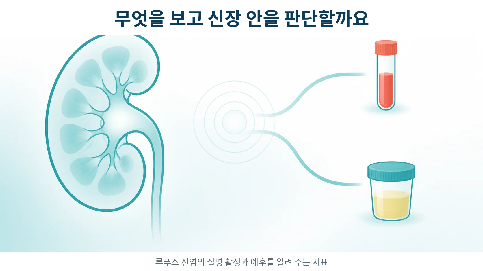 루푸스 신염에서 무엇을 보고 활성을 판단하는가