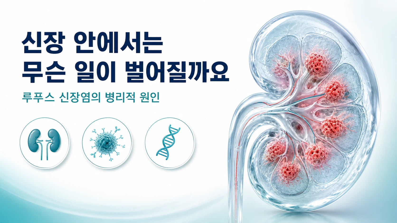 루푸스 신장염의 병리적 원인