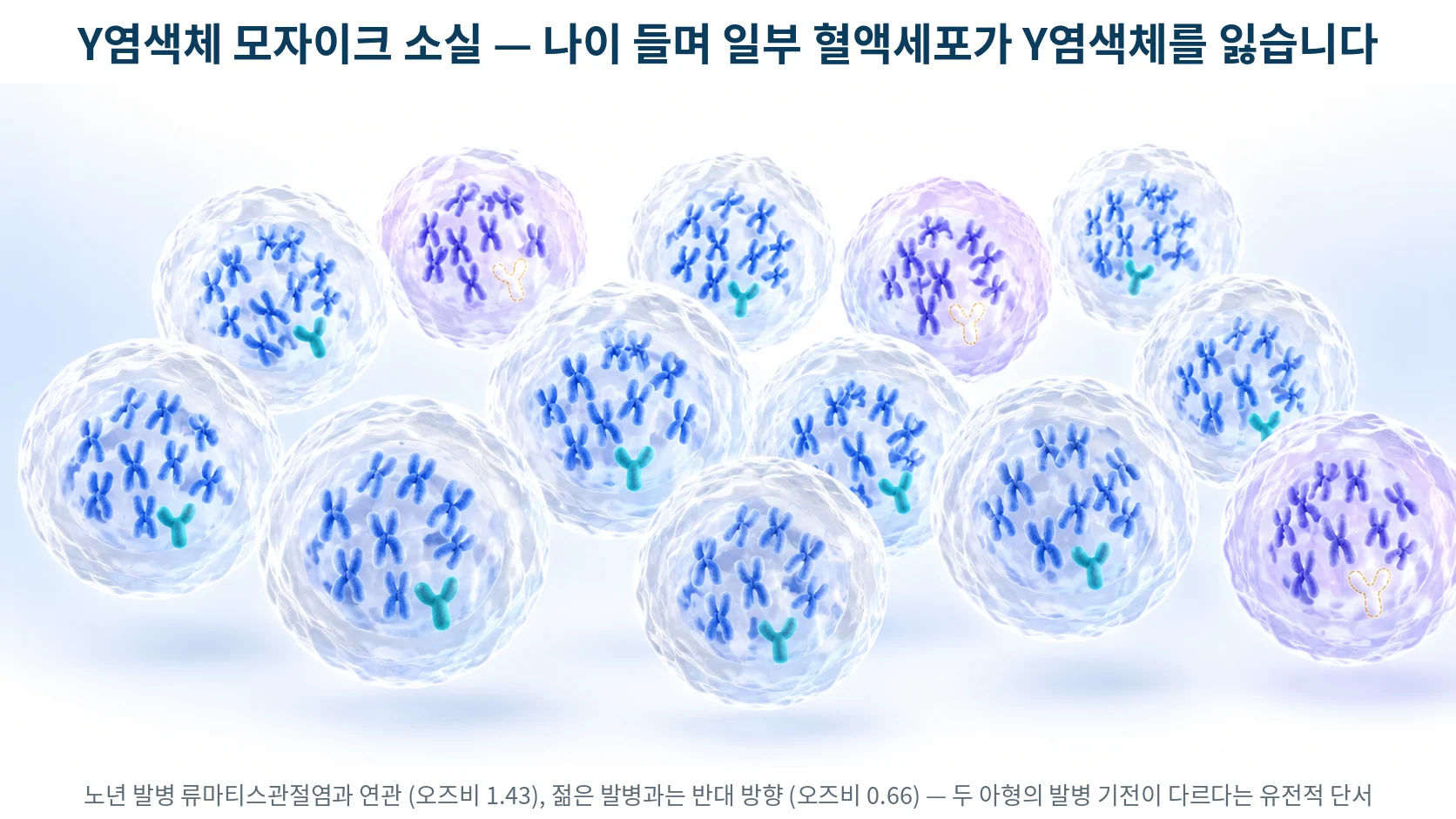 혈액세포 일부가 Y염색체를 잃는 모자이크 소실 현상을 표현한 3D 의료 일러스트