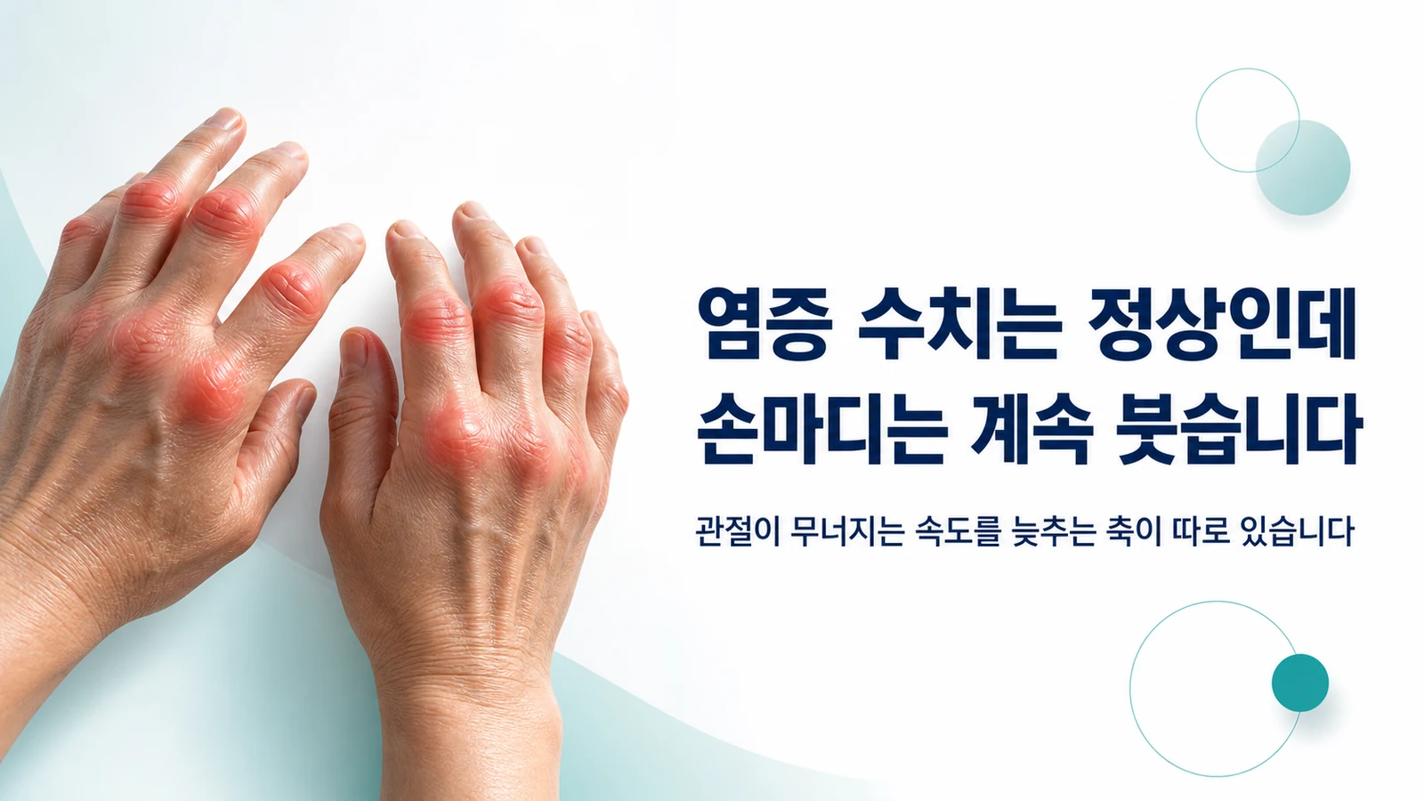 손마디가 붓고 아침에 펴지지 않는 손을 보여주며 관절이 무너지는 속도를 늦추는 축이 따로 있다고 설명하는 이미지